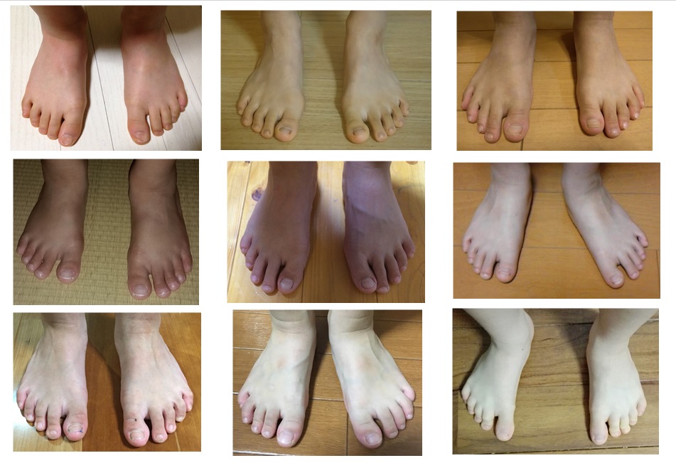 足指写真集